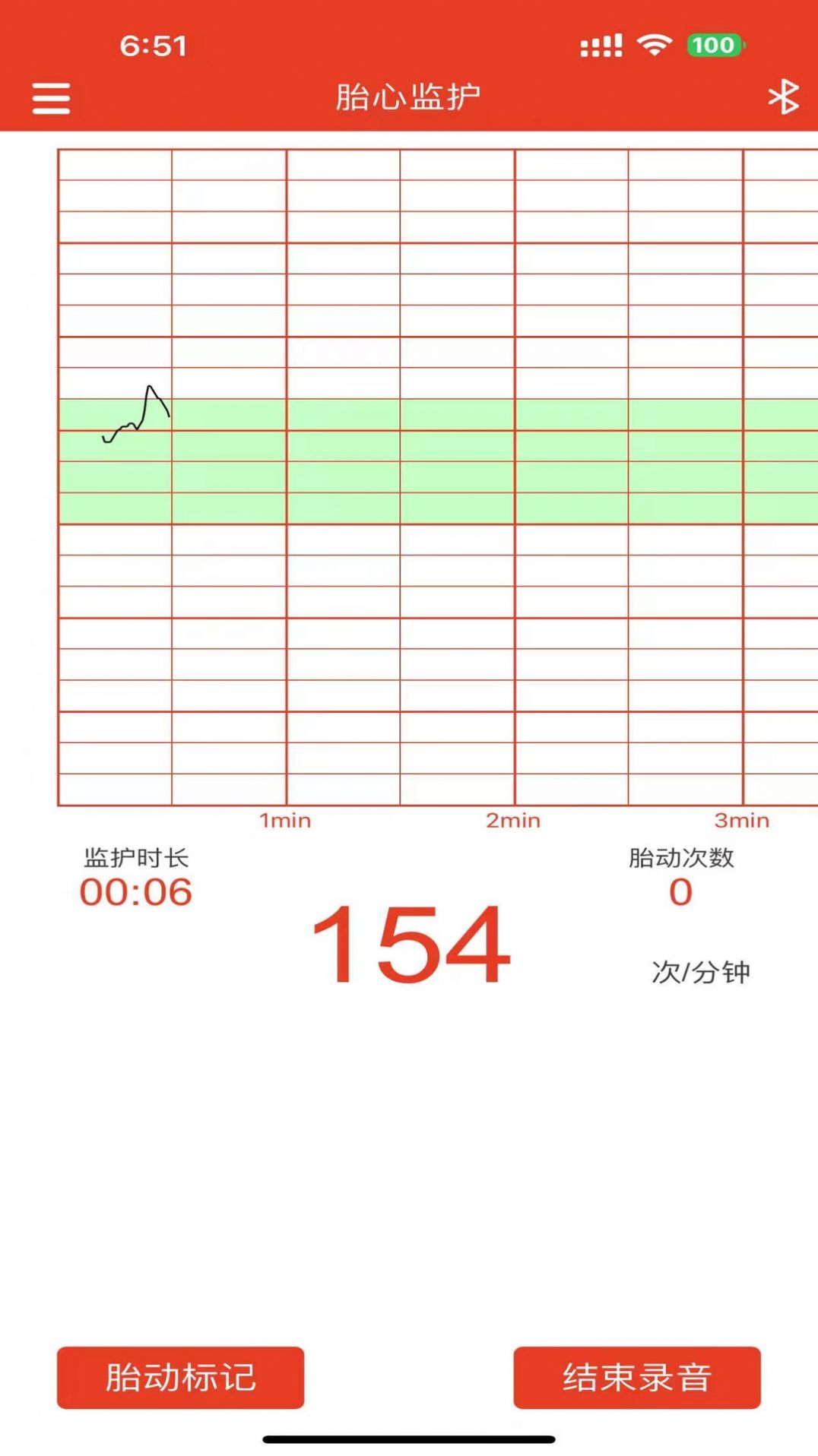 左点胎心仪app手机版下载v1.0