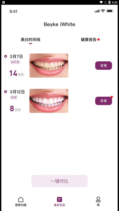 Beyke iWhite牙齿美白管理app手机版下载v1.0.0