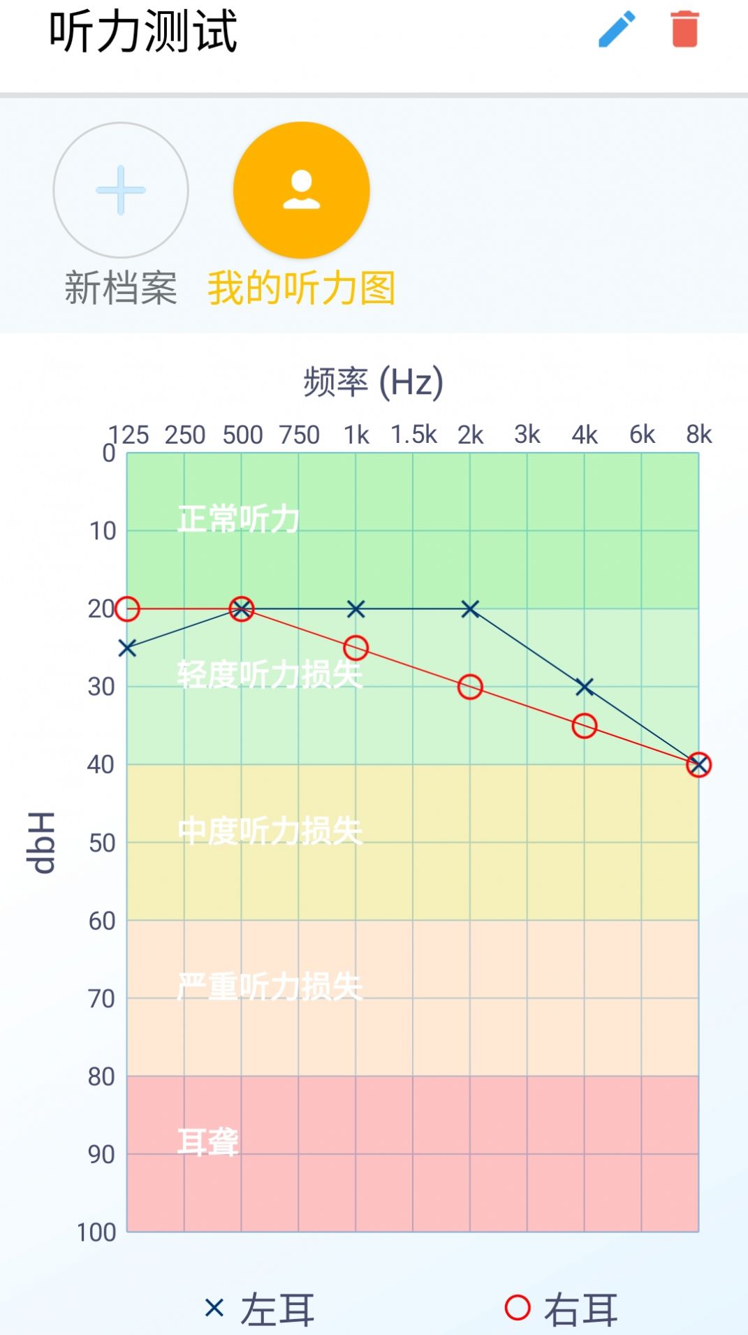 艾米助听下载app安卓版v1.0