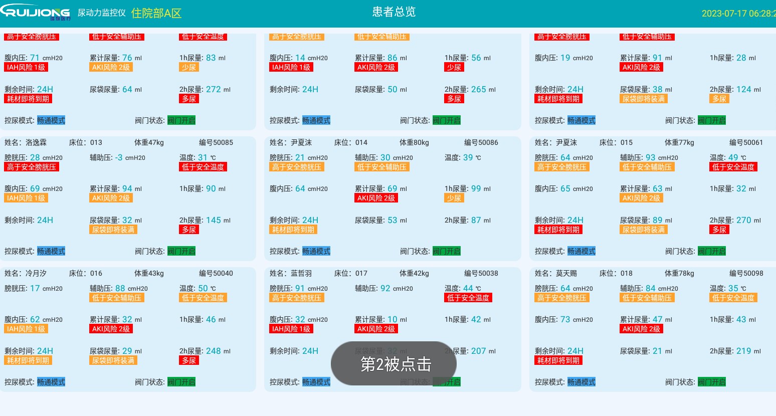 尿动力大屏监测仪软件下载v1.0.0